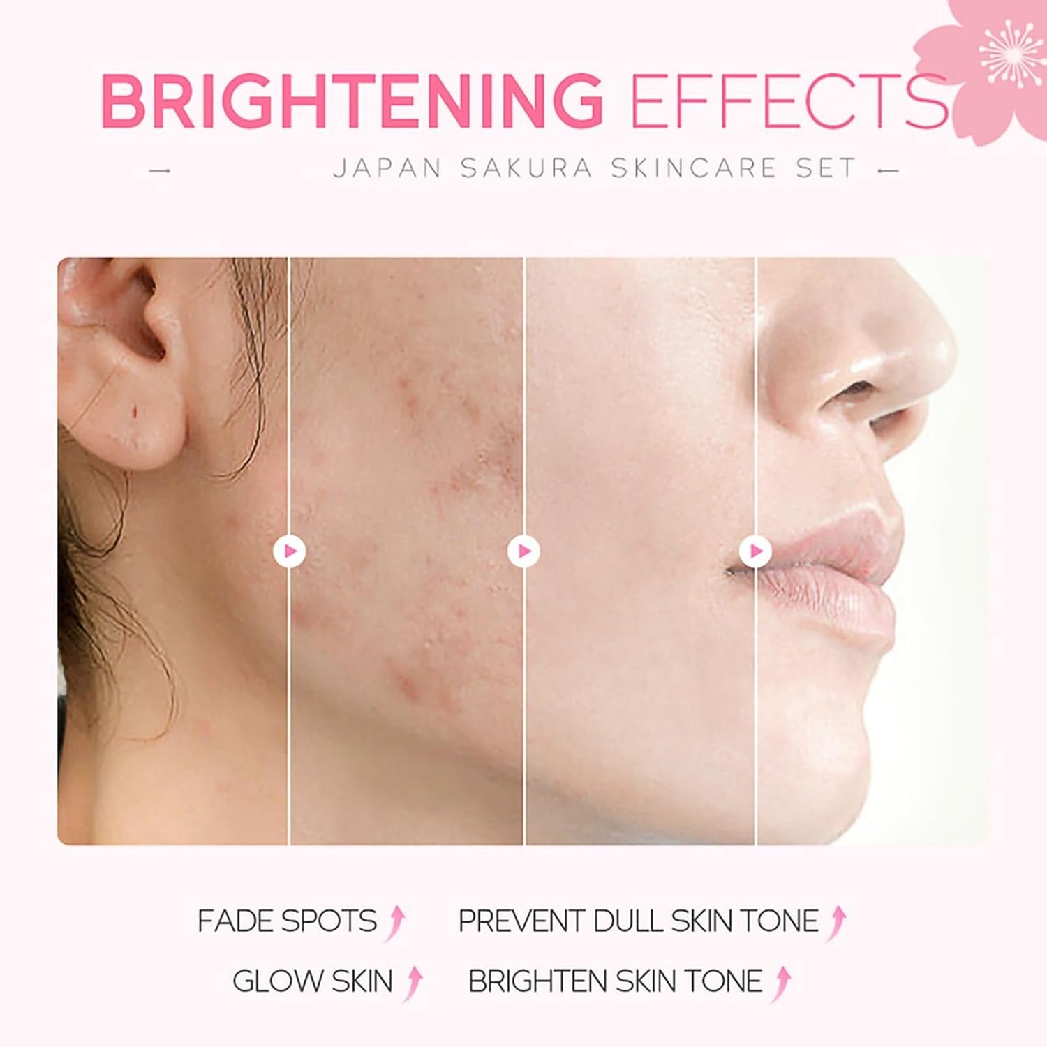 Skincare Gifts For Teenage Girls,Cherry Blossom Skincare Sets,Facial kit,Pamper Sets For Women Gifts - Image 3