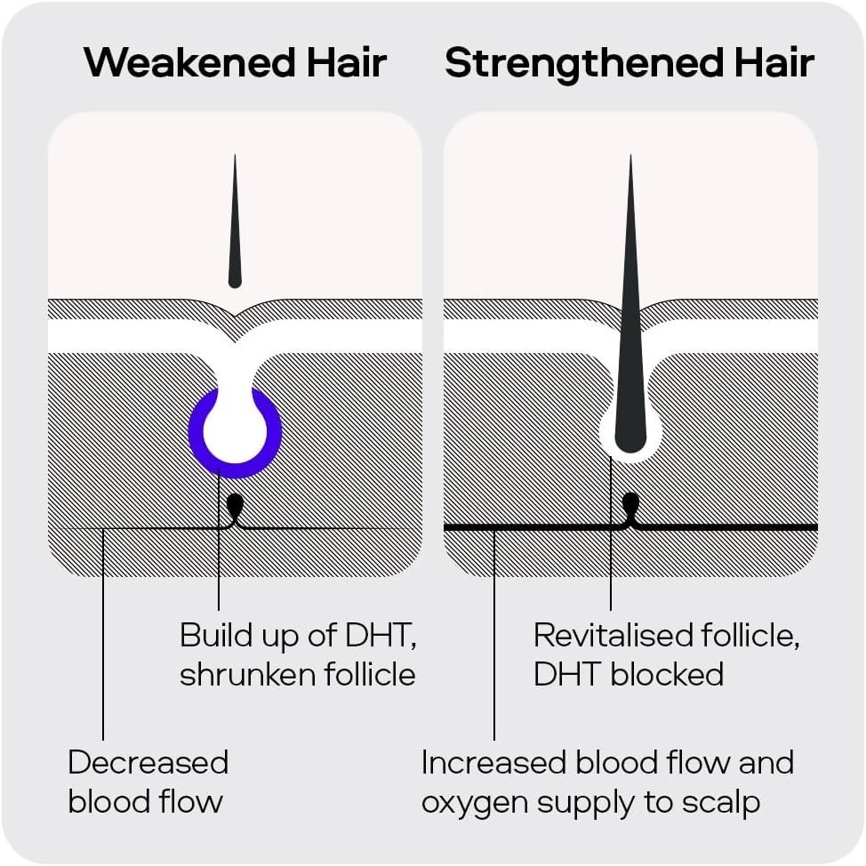 Sons Complete Hair Loss Treatment - Minoxidil 5%, Biotin, & DHT Blocking Shampoo + Dermaroller, 3 Month Supply - Image 5