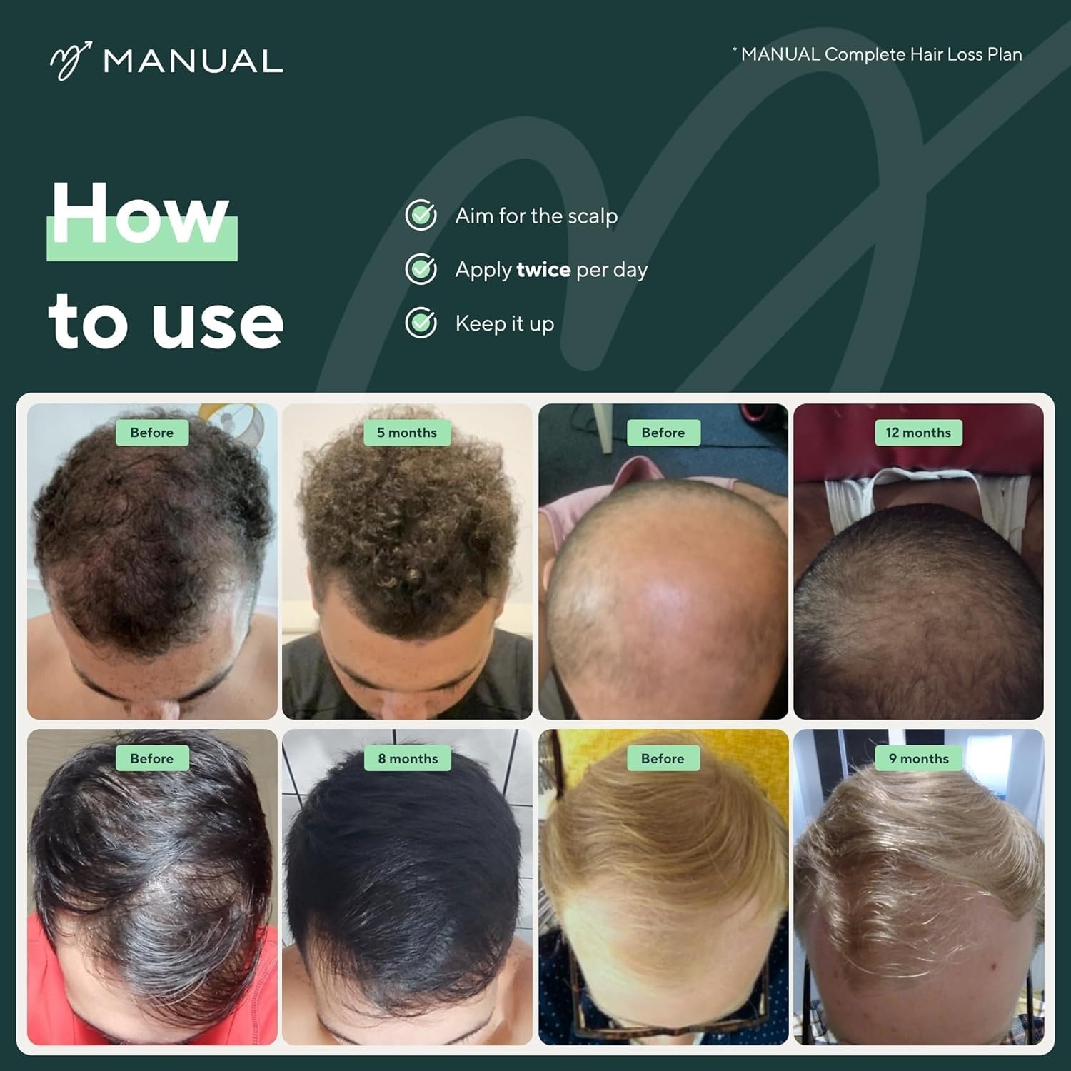 Manual 5% Minoxidil (1 x 60ml) Formula For Men - Increases Blood Flow To Follicles, 1 Month Supply - Image 5